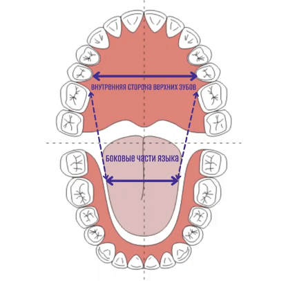 полость рта флепйтиста